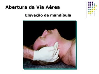 Abertura da Via Aérea
Elevação da mandíbulaElevação da mandíbula
 