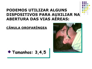 PODEMOS UTILIZAR ALGUNS
DISPOSITIVOS PARA AUXILIAR NA
ABERTURA DAS VIAS AÉREAS:
CÂNULA OROFARÍNGEA
 Tamanhos: 3,4,5Tamanhos: 3,4,5 Tamanhos: 3,4,5Tamanhos: 3,4,5
 