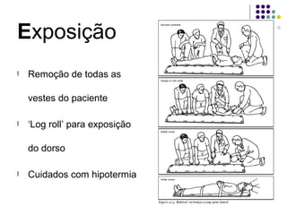Exposição
l Remoção de todas as
vestes do paciente
l ‘Log roll’ para exposição
do dorso
l Cuidados com hipotermia
 
