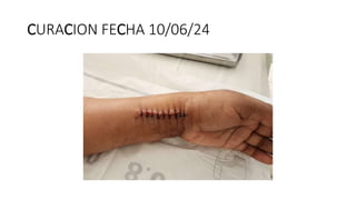 CURACION FECHA 10/06/24
 