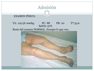 Admisión
EXAMEN FÍSICO:
 TA: 119/56 mmhg. FC: 88 FR: 20 Tº:35.6
SatO2: 97%
 Resto del examen NORMAL. Excepto lo que ven..
 