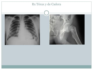 Rx Tórax y de Cadera
 