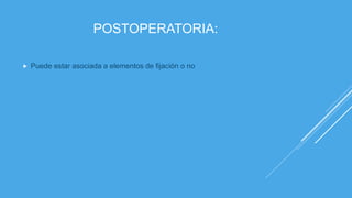 POSTOPERATORIA:
 Puede estar asociada a elementos de fijación o no
 