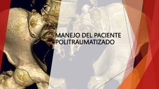 MANEJO DEL PACIENTE
POLITRAUMATIZADO
 