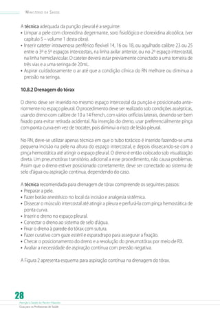 Atenção à Saúde do Recém-Nascido
Guia para os Profissionais de Saúde
28
Ministério da Saúde
A técnica adequada da punção pleural é a seguinte:
•	Limpar a pele com clorexidina degermante, soro fisiológico e clorexidina alcoólica, (ver
capítulo 5 – volume 1 desta obra).
•	Inserir cateter intravenosa periférico flexível 14, 16 ou 18, ou agulhado calibre 23 ou 25
entre o 3º e 5º espaços intercostais, na linha axilar anterior, ou no 2º espaço intercostal,
na linha hemiclavicular. O cateter deverá estar previamente conectado a uma torneira de
três vias e a uma seringa de 20mL.
•	Aspirar cuidadosamente o ar até que a condição clínica do RN melhore ou diminua a
pressão na seringa.
10.8.2 Drenagem do tórax
O dreno deve ser inserido no mesmo espaço intercostal da punção e posicionado ante-
riormente no espaço pleural. O procedimento deve ser realizado sob condições assépticas,
usando dreno com calibre de 10 a 14 French, com vários orifícios laterais, devendo ser bem
fixado para evitar retirada acidental. Na inserção do dreno, usar preferencialmente pinça
com ponta curva em vez de trocater, pois diminui o risco de lesão pleural.
No RN, deve-se utilizar apenas técnica em que o tubo torácico é inserido fazendo-se uma
pequena incisão na pele na altura do espaço intercostal, e depois dissecando-se com a
pinça hemostática até atingir o espaço pleural. O dreno é então colocado sob visualização
direta. Um pneumotórax transitório, adicional a esse procedimento, não causa problemas.
Assim que o dreno estiver posicionado corretamente, deve ser conectado ao sistema de
selo d’água ou aspiração contínua, dependendo do caso.
A técnica recomendada para drenagem de tórax compreende os seguintes passos:
•	Preparar a pele.
•	Fazer botão anestésico no local da incisão e analgesia sistêmica.
•	Dissecar o músculo intercostal até atingir a pleura e perfurá-la com pinça hemostática de
ponta curva.
•	Inserir o dreno no espaço pleural.
•	Conectar o dreno ao sistema de selo d’água.
•	Fixar o dreno à parede do tórax com sutura.
•	Fazer curativo com gaze estéril e esparadrapo para assegurar a fixação.
•	Checar o posicionamento do dreno e a resolução do pneumotórax por meio de RX.
•	Avaliar a necessidade de aspiração contínua com pressão negativa.
A Figura 2 apresenta esquema para aspiração contínua na drenagem do tórax.
 