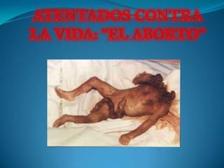 ATENTADOS CONTRA LA VIDA: “EL ABORTO”  