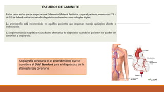 Angiografía coronaria es el procedimiento que se
considera el Gold Standard para el diagnóstico de la
aterosclerosis coronaria
 