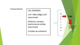 CML
PLACAS DE
ATEROMA
 