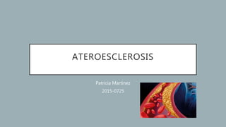 ATEROESCLEROSIS
Patricia Martinez
2015-0725
 