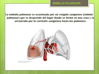 La embolia pulmonar es ocasionada por un coágulo sanguíneo (émbolo
 pulmonar) que se desprende del lugar donde se formó en una vena y es
      arrastrado por la corriente sanguínea hasta los pulmones.
 