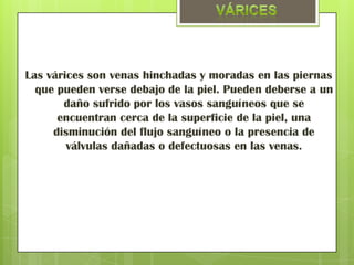 Las várices son venas hinchadas y moradas en las piernas
  que pueden verse debajo de la piel. Pueden deberse a un
       daño sufrido por los vasos sanguíneos que se
      encuentran cerca de la superficie de la piel, una
     disminución del flujo sanguíneo o la presencia de
        válvulas dañadas o defectuosas en las venas.
 