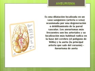 Es una dilatación localizada en un
   vaso sanguíneo (arteria o vena)
  ocasionada por una degeneración
     o debilitamiento de la pared
    vascular. Los aneurismas más
  frecuentes son los arteriales y su
localización más habitual radica en
 la base del cerebro (el polígono de
     Willis) y la aorta (la principal
    arteria que sale del corazón) -
           Aneurisma de aorta
 