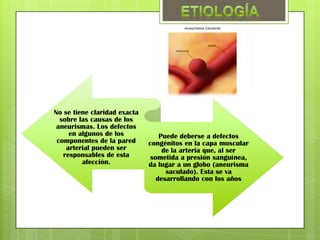 No se tiene claridad exacta
  sobre las causas de los
 aneurismas. Los defectos
     en algunos de los            Puede deberse a defectos
 componentes de la pared      congénitos en la capa muscular
    arterial pueden ser            de la arteria que, al ser
   responsables de esta        sometida a presión sanguínea,
         afección.            da lugar a un globo (aneurisma
                                    saculado). Esta se va
                                 desarrollando con los años
 