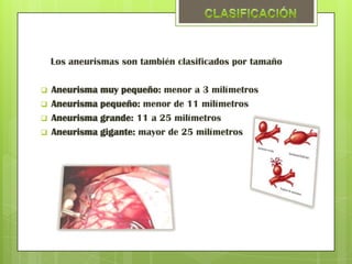 Los aneurismas son también clasificados por tamaño

   Aneurisma muy pequeño: menor a 3 milímetros
   Aneurisma pequeño: menor de 11 milímetros
   Aneurisma grande: 11 a 25 milímetros
   Aneurisma gigante: mayor de 25 milímetros
 