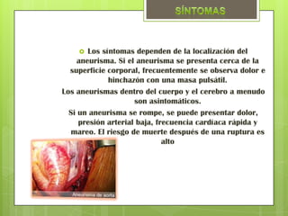   Los síntomas dependen de la localización del
    aneurisma. Si el aneurisma se presenta cerca de la
  superficie corporal, frecuentemente se observa dolor e
             hinchazón con una masa pulsátil.
Los aneurismas dentro del cuerpo y el cerebro a menudo
                     son asintomáticos.
  Si un aneurisma se rompe, se puede presentar dolor,
     presión arterial baja, frecuencia cardíaca rápida y
  mareo. El riesgo de muerte después de una ruptura es
                              alto
 