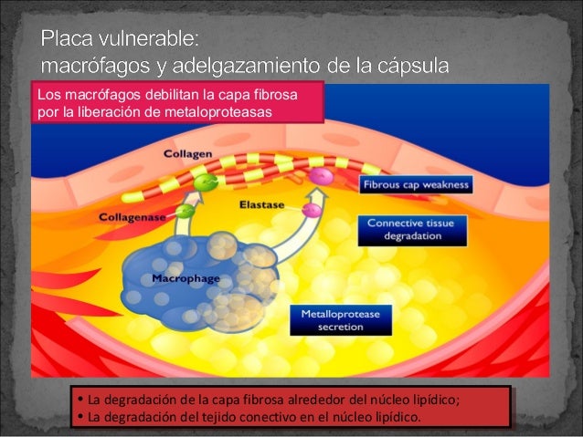 La maqueta de entrenamiento más eficaz para el adelgazamiento en las condiciones de casa