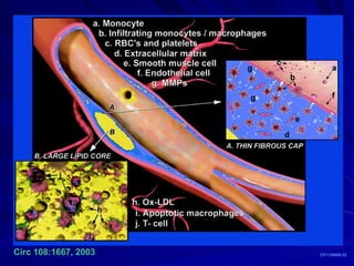 CP1130695-22 Circ 108:1667, 2003 