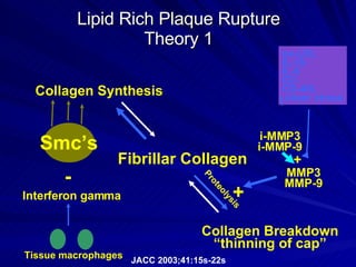 Lipid Rich Plaque Rupture Theory 1 Fibrillar Collagen Collagen Synthesis Collagen Breakdown “ thinning of cap” Proteolysis + MMP3 MMP-9 i-MMP3 i-MMP-9 ox-LDL IL-1b IL-6 O2- CD-40L sheer stress + Smc’s - Interferon gamma Tissue macrophages JACC 2003;41:15s-22s 