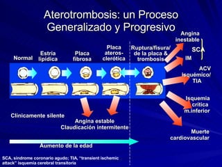 Aterotrombosis: un Proceso Generalizado y Progresivo Normal Estría lipídica Placa fibrosa Placa ateros- clerótica Ruptura/fisura/ de la placa & trombosis IM Isquemia crítica  m.inferior Clínicamente silente Muerte cardiovascular Aumento de la edad Angina estable Claudicación intermitente Angina inestable SCA SCA, síndrome coronario agudo; TIA, “transient ischemic attack” isquemia cerebral transitoria ACV isquémico/ TIA  