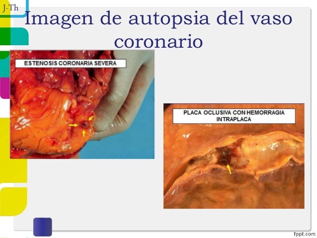 Como aumentar el pecho por medio del masaje o los ejercicios