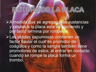 A medida que se agregan mas sustancias
 y células a la placa esta va creciendo y
 por tanto termina por romperse.
Las células espumosas contienen un
 factor tisular el cual es promotor de
 coágulos y como la sangre también tiene
 promotores de estos, al entrar en contacto
 cuando se rompe la placa forma un
 trombo.
 