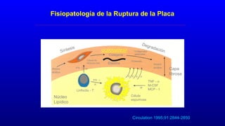 Fisiopatología de la Ruptura de la Placa
Síntesis
Degradación
Amino
ácidos
Célula de
Músculo liso
Colágena
Elastina
Colagenasa
gelatinasa
Proteasas
Amino
ácidos
Célula
espumosa
IFN - γ
IFN - γ
Linfocito - T
Núcleo
Lipídico
Capa
fibrosa
TNF - α
M-CSF
MCP - 1
Circulation 1995;91:2844-2850
 