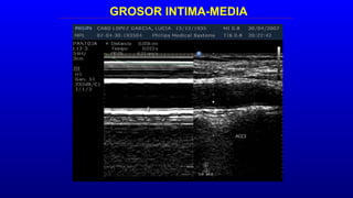 GROSOR INTIMA-MEDIA
 