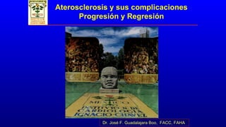 Aterosclerosis y sus complicaciones
Progresión y Regresión
Dr. José F. Guadalajara Boo, FACC, FAHA
 