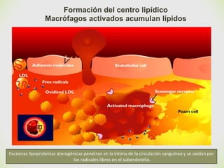 🙢
Formación del centro lipídico
Macrófagos activados acumulan lípidos
Excesivas lipoproteínas aterogénicas penetran en la íntima de la circulación sanguínea y se oxidan por
los radicales libres en el subendotelio.
 