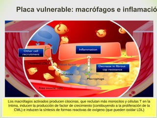 🙢
Placa vulnerable: macrófagos e inflamació
Los macrófagos activados producen citocinas, que reclutan más monocitos y células T en la
íntima, inducen la producción de factor de crecimiento (contibuyendo a la proliferación de la
CML) e inducen la síntesis de formas reactivas de oxígeno (que pueden oxidar LDL)
 