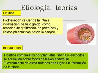 🙢
Lipídica
Proliferación celular de la íntima
inflamación de bajo grado, como
reacción de ↑ filtración de proteínas y
lípidos plasmáticos desde la sangre.
Incrustación
Trombos compuestos por plaquetas, fibrina y leucocitos
se acumulan sobre focos de lesión endotelial.
El crecimiento de estos trombos dan lugar a la formación
de la placa
Etiología: teorías
 
