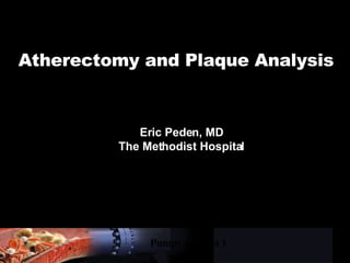 Pumps & Pipes 1 Atherectomy and Plaque Analysis Eric Peden, MD The Methodist Hospital 