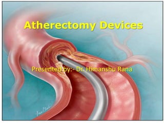 Atherectomy Devices
Presented by:- Dr. Himanshu Rana
 