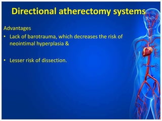 Directional atherectomy systems
Advantages
• Lack of barotrauma, which decreases the risk of
neointimal hyperplasia &
• Lesser risk of dissection.
 