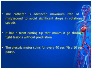 • The catheter is advanced maximum rate of 1
mm/second to avoid significant drops in rotational
speeds
• It has a front-cutting tip that makes it go through
tight lesions without predilation
• The electric motor spins for every 40 sec f/b a 10 sec.
pause.
 