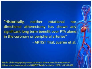“Historically, neither rotational nor
directional atherectomy has shown any
significant long term benefit over PTA alone
in the coronary or peripheral arteries”
- ARTIST Trial; Jueren et al.
Results of the Angioplasty versus rotational atherectomy for treatment of
diffuse in-stent re-stenosis trial (ARTIST Trial) Circulation. 2002; 105:583-588
 
