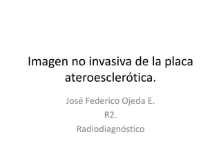 Imagen no invasiva de la placa
ateroesclerótica.
José Federico Ojeda E.
R2.
Radiodiagnóstico
 