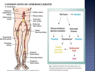 COMMON SITES OF ATHEROSCLEROTIC
LESIONS:
 