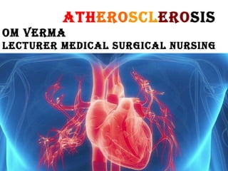 ATHEROSCLEROSIS
Om vERmA
LECTuRER mEdICAL SuRgICAL nuRSIng
 