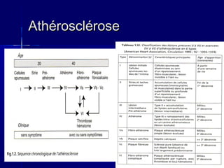 AAtthhéérroosscclléérroossee 
