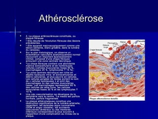 AAtthhéérroosscclléérroossee 
 22.. LLaa ppllaaqquuee aarrttéérroosscclléérreeuussee ccoonnssttiittuuééee,, oouu 
ppllaaqquuee ffiibbrreeuussee 
 •• EEllllee rrééssuullttee ddee ll''éévvoolluuttiioonn ffiibbrreeuussee ddeess llééssiioonnss 
pprrééccééddeenntteess.. 
 •• EEllllee aappppaarraaîîtt mmaaccrroossccooppiiqquueemmeenntt ccoommmmee uunnee 
llééssiioonn ssaaiillllaannttee,, bbllaanncc ggrriissââttrree,, ddaannss llaa lluummiièèrree 
dduu vvaaiisssseeaauu.. 
 SSuurr llee ppllaann hhiissttoollooggiiqquuee,, oonn oobbsseerrvvee uunn 
eennddootthhéélliiuumm vvaassccuullaaiirree aannaattoommiiqquueemmeenntt nnoorrmmaall 
rreeccoouuvvrraanntt uunn iimmppoorrttaanntt ééppaaiissssiisssseemmeenntt 
iinnttiimmaall,, ccoommppoosséé dd''uunnee cchhaappee ffiibbrreeuussee 
eennttoouurraanntt uunnee zzoonnee cceennttrraallee nnééccrroottiiqquuee.. 
 **LLaa cchhaappee ffiibbrreeuussee ccoonnttiieenntt uunnee aabboonnddaannttee 
mmaattrriiccee eexxttrraacceelllluullaaiirree eett ddee nnoommbbrreeuusseess 
cceelllluulleess ((cceelllluulleess mmuussccuullaaiirreess lliisssseess 6600 %%,, 
mmaaccrroopphhaaggeess 2255 %%,, llyymmpphhooccyytteess TT 1155 %%)).. 
 **LLaa zzoonnee cceennttrraallee nnééccrroottiiqquuee eesstt rriicchhee eenn 
ddééppôôttss lliippiiddiiqquueess iinnttrraa-- eett eexxttrraacceelllluullaaiirreess eett 
ddéébbrriiss cceelllluullaaiirreess,, eett pplluuss ppaauuvvrree eenn cceelllluulleess.. 
LLeess cceelllluulleess ggoorrggééeess ddee lliippiiddeess ppoorrtteenntt llee nnoomm 
ddee « cceelllluulleess ssppuummeeuusseess » eett ssoonntt ddeess 
mmaaccrroopphhaaggeess oouu ddeess cceelllluulleess mmuussccuullaaiirreess 
lliisssseess.. LLeess mmaaccrroopphhaaggeess rreepprréésseenntteenntt 6600 %% 
ddeess cceelllluulleess ddee cceettttee zzoonnee,, lleess cceelllluulleess 
mmuussccuullaaiirreess lliisssseess 300 %% eett lleess llyymmpphhooccyytteess TT 
1100 %%.. 
 UUnnee nnééoo vvaassccuullaarriissaattiioonn ssee ddéévveellooppppee ddee llaa 
ppéérriipphhéérriiee vveerrss llee cceennttrree.. **LLaa mmeeddiiaa eesstt ppaarrffooiiss 
nnoorrmmaallee,, ppaarrffooiiss ffrraaggmmeennttééee.. 
 LLaa ppllaaqquuee aatthhéérroommaatteeuussee ccoonnssttiittuuee uunnee 
oobbssttrruuccttiioonn ssiiggnniiffiiccaattiivvee ddee llaa lluummiièèrree aarrttéérriieellllee;; 
cceeppeennddaanntt,, lleess ééppiissooddeess aaiigguuss ccoorroonnaarriieennss 
((DDDDMM eett aannggoorr iinnssttaabbllee)),, lleess aacccciiddeennttss 
vvaassccuullaaiirreess ccéérréébbrraauuxx oouu ddeess mmeemmbbrreess 
iinnfféérriieeuurrss ccoorrrreessppoonnddeenntt llee pplluuss ssoouuvveenntt àà 
ll''aappppaarriittiioonn dd''uunnee ccoommpplliiccaattiioonn aauu nniivveeaauu ddee llaa 
ppllaaqquuee.. 
 