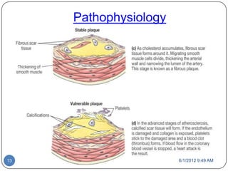 Pathophysiology




13                     6/1/2012 9:49 AM
 