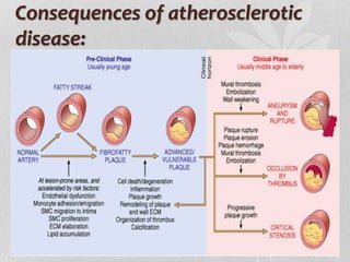 Consequences of atherosclerotic
disease:
 