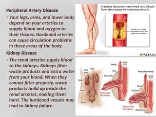 Peripheral Artery Disease
• Your legs, arms, and lower body
depend on your arteries to
supply blood and oxygen to
their tissues. Hardened arteries
can cause circulation problems
in these areas of the body.
Kidney Disease
• The renal arteries supply blood
to the kidneys. Kidneys filter
waste products and extra water
from your blood. When they
cannot filter properly, waste
products build up inside the
renal arteries, making them
hard. The hardened vessels may
lead to kidney failure.
 