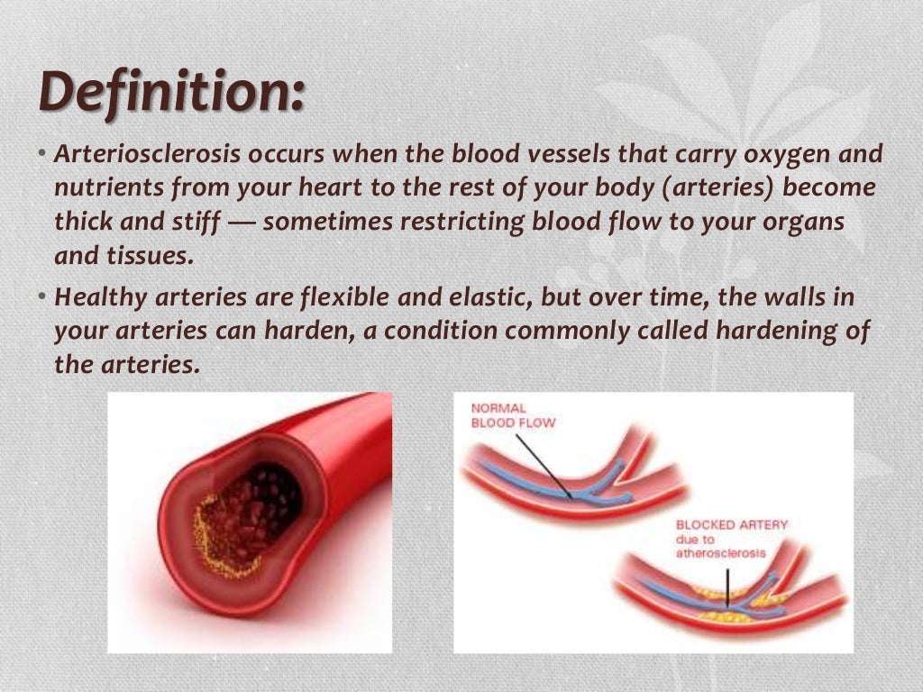 Atherosclerosis atherosclerosis