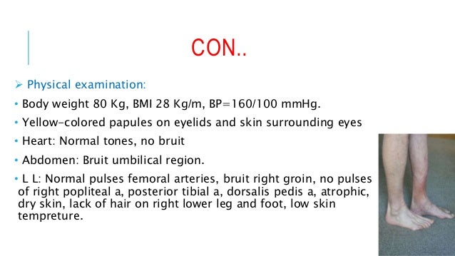 Types of arteriosclerosis picture