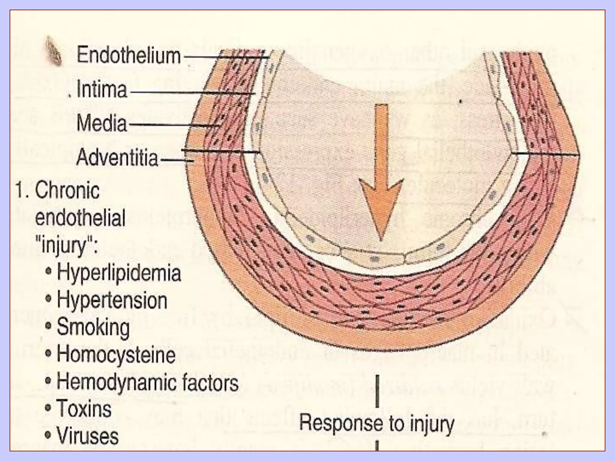 Atherosclerosis pathology mbbs | PPTX