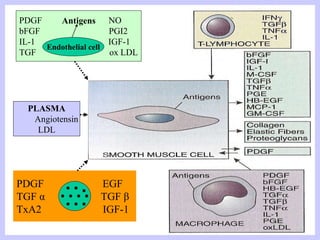 PDGF NO
bFGF PGI2
IL-1 IGF-1
TGF ox LDL
Endothelial cell
Antigens
PDGF EGF
TGF α TGF β
TxA2 IGF-1
PLASMA
Angiotensin
LDL
 