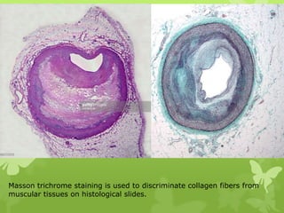 Masson trichrome staining is used to discriminate collagen fibers from
muscular tissues on histological slides.
 