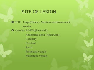 SITE OF LESION
 SITE: Large(Elastic) ,Medium sized(muscular)
arteries
 Arteries: AORTA(Post.wall)
Abdominal aorta (Aneurysm)
Coronary
Cerebral
Renal
Peripheral vessels
Mesenteric vessels
 